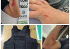 LESIONÓ A DOS EMPLEADOS POLICIALES PARA IMPEDIR SER APREHENDIDO