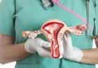 ALERTAN SOBRE LA DEMORA EN EL DIAGNÓSTICO Y TRATAMIENTO DEL CÁNCER DE OVARIO