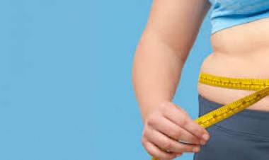 LA OBESIDAD REQUIERE MENOS PREJUICIOS Y MÁS ACOMPAÑAMIENTO MÉDICO